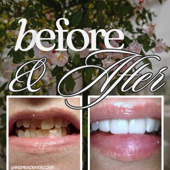 Inspira Dental Care - General Dentistry Near Me - Mocksville, North Carolina Inspira Dental Care - General Dentistry Near Me - Mocksville, North Carolina