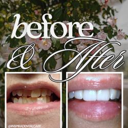 Inspira Dental Care
