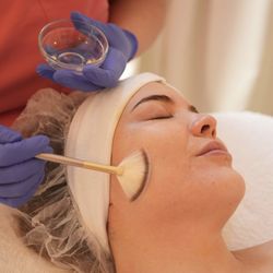 Victorious Skincare - Chemical Peels