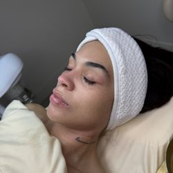 Anais Aesthetics - Rejuvenating facial results ! Beautiful glowing skin !