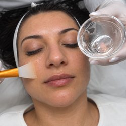 THESERA G Korean Spicule Bio-Microneedling treatment at Iris Beauty Solution in Vancouver. A non-invasive skin renewal treatment .