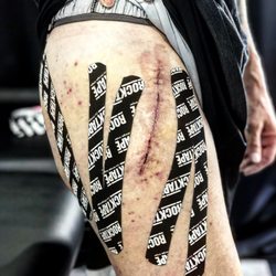 VegaFit Recovery - Total hip replacement application