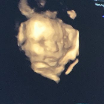 Unique Ultrasound - Diagnostic Imaging Near Me - Temecula, California