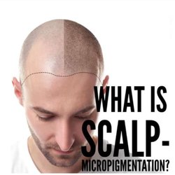 New Image by Hilary - Welcome to "SMP" Scalp Micropigmentation for male and female hair loss. It's never too late to look years younger. Best option to hair plugs