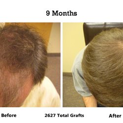 Advanced Medical Hair Institute