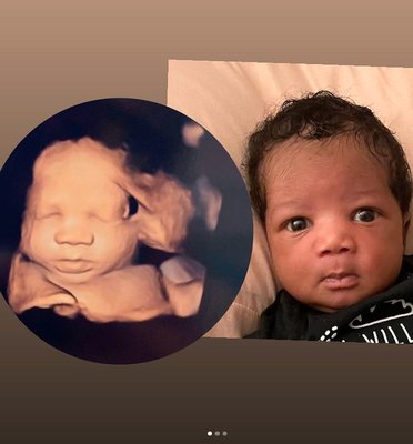 High Definition Before & After Photos! - Here are some of our High Definition Ultrasound Photos side by side with the newborns after birth! We offer the highest quality imaging around, come see for yourself and book today!