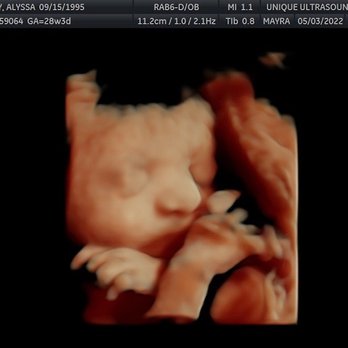 Unique Ultrasound Redlands - Ultrasound Imaging Centers Near Me - Redlands, California