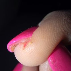 Divine Nails & Spa - Another cut and glue irritation under nail... this was all in a days time from the actual mani