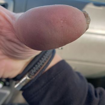 Reno Nail Spa - After she cut my finger..not a big deal..she denied it. - Nail Salons Near Me - Reno, Nevada Reno Nail Spa - After she cut my finger..not a big deal..she denied it. - Nail Salons Near Me - Reno, Nevada