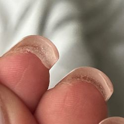 Natural Nails - Glue under my nail .