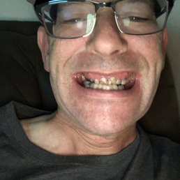 This is the before picture