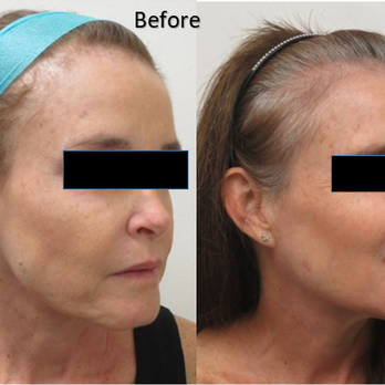 True Vision Center - Sculptra - Ophthalmologists Near Me - Honolulu, Hawaii True Vision Center - Sculptra - Ophthalmologists Near Me - Honolulu, Hawaii