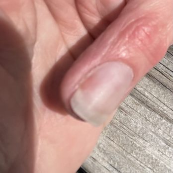 Alux Spa - The red/pink is damaged nail bed. - Nail Salons Near Me - Brighton, Michigan