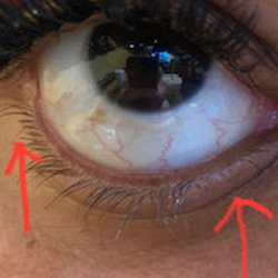 Blink Beautiful - Half bottom (Both corners) lashes cut completely off