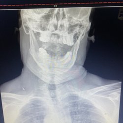 Does this look right. This urgent care would not know. They took no X-rays.