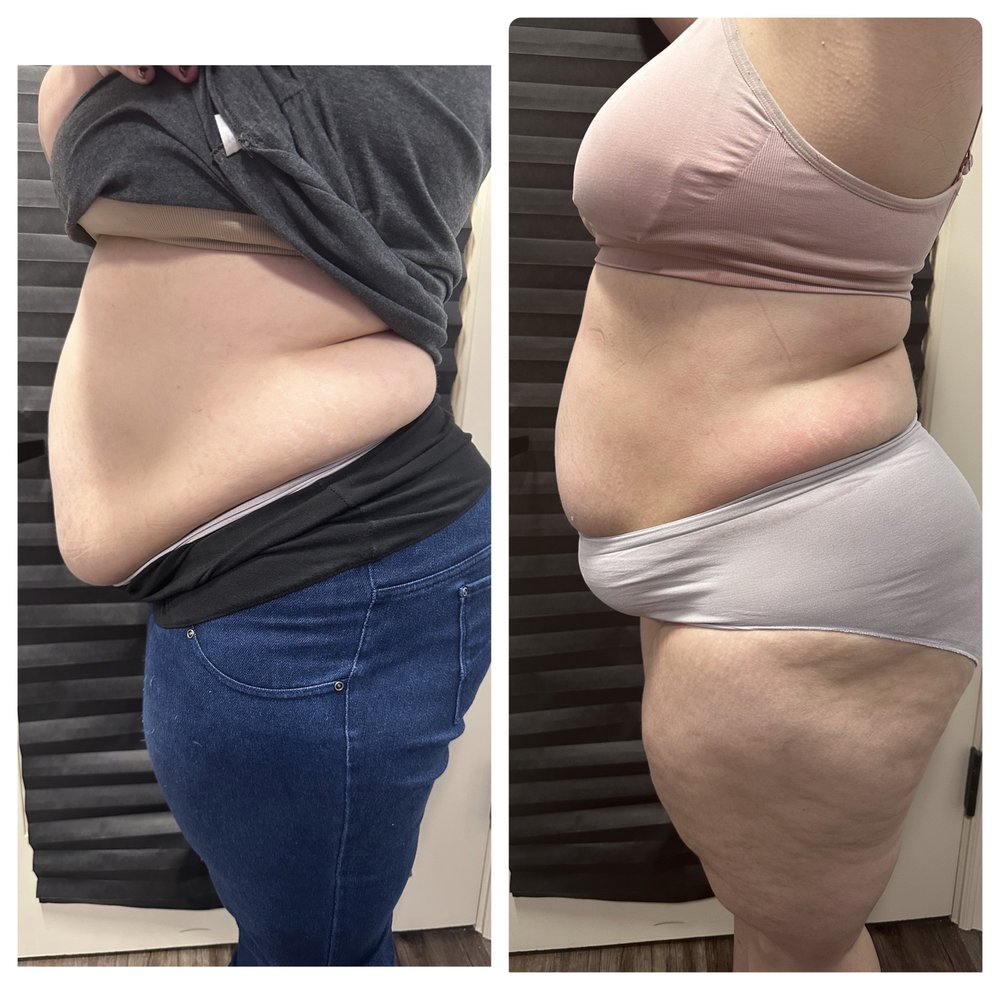 peptide sciences semaglutide mixing instructions The weight-loss-independent hepatoprotective benefits of semaglutide are  orchestrated by intrahepatic sinusoidal endothelial GLP-1 receptors: Cell  Metabolism