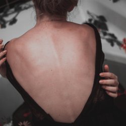 Secrest Health & Wellness - Chiropractic; Back Pain, Neck Pain
