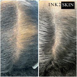 Ink2Skin - SMP Density