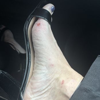 Soho Nails - Skin removed from my foot and ankle from a pedicure at SOHO in Farragut, TN. - Nail Salons Near Me - Knoxville, Tennessee Soho Nails - Skin removed from my foot and ankle from a pedicure at SOHO in Farragut, TN. - Nail Salons Near Me - Knoxville, Tennessee