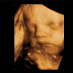 Take A Peep - 3D & 4D Ultrasound