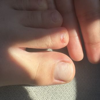 Lavish Nails - half missing toe nail - Nail Salons Near Me - Pearland, Texas Lavish Nails - half missing toe nail - Nail Salons Near Me - Pearland, Texas