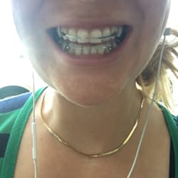 Curry & Oh Orthodontics - Fits like a glove!!