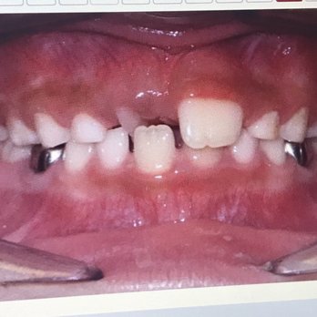 Advance Orthodontics - John Karotkin, DDS MS - Orthodontists Near Me - Houston, Texas Advance Orthodontics - John Karotkin, DDS MS - Orthodontists Near Me - Houston, Texas