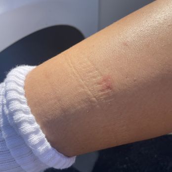 Garden Inn & Suites - Bed bugs from the garden inn motel - Hotels Near Me - Glendora, California Garden Inn & Suites - Bed bugs from the garden inn motel - Hotels Near Me - Glendora, California