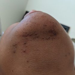 Shapes Brow Bar - My chin looks hairy but it is cuts