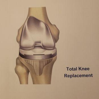 All Star Physical Therapy - My knee after All Star helped my handicap rehabilitation recover! - Physical Therapy Near Me - Murrieta, California All Star Physical Therapy - My knee after All Star helped my handicap rehabilitation recover! - Physical Therapy Near Me - Murrieta, California