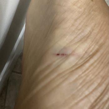 Halo Day Spa - Cut from pedicure! Ouch!!! Kate was nail tech. - Nail Salons Near Me - Columbia, Maryland