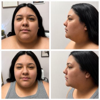 Luxe Contour - Facial lymph and lift service - Body Contouring Near Me - Ontario, California Luxe Contour - Facial lymph and lift service - Body Contouring Near Me - Ontario, California
