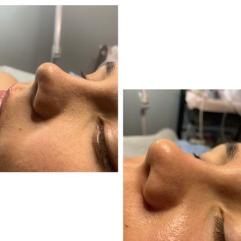 Chans Beauty Bar - Deep cleansing of the pores - Skin Care Near Me - Tampa, Florida Chans Beauty Bar - Deep cleansing of the pores - Skin Care Near Me - Tampa, Florida