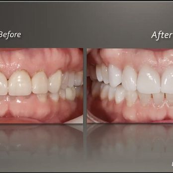 Hugh Murphy DDS, MS, FACP - Premier Prosthodontics - Cosmetic Dentists Near Me - Raleigh, North Carolina Hugh Murphy DDS, MS, FACP - Premier Prosthodontics - Cosmetic Dentists Near Me - Raleigh, North Carolina