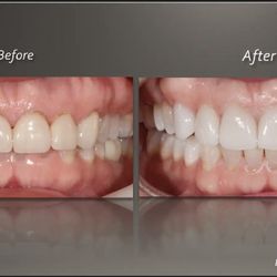 Hugh Murphy DDS, MS, FACP - Premier Prosthodontics