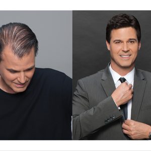 HRC - Hair Restoration of California on Yelp