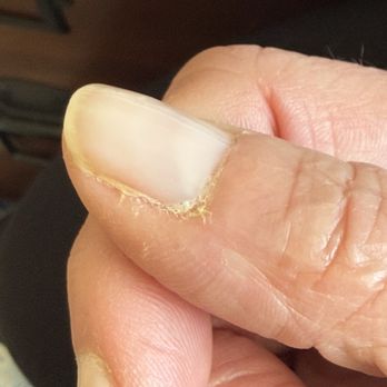 Pink Nail Lounge & Spa - Nail beds not properly cleaned up before polishing, resulted in the polish lifting one every nail in a week. - Nail Technicians Near Me - Park Ridge, Illinois Pink Nail Lounge & Spa - Nail beds not properly cleaned up before polishing, resulted in the polish lifting one every nail in a week. - Nail Technicians Near Me - Park Ridge, Illinois