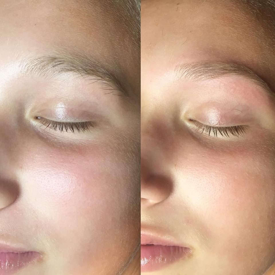 Beauty Mark