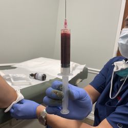 MD Now Urgent Care - Drawing fluid out of excess from elbow