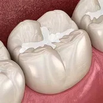 Fred Bubernak, DDS - General Dentistry Near Me - Woodbridge, Virginia