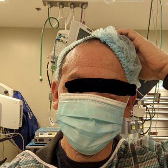 Lawton W Tang, MD - Pre op, view of lipoma on right temple. - Cosmetic Surgeons Near Me - Pasadena, California Lawton W Tang, MD - Pre op, view of lipoma on right temple. - Cosmetic Surgeons Near Me - Pasadena, California