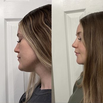 Dallas Surgical Arts: Randy R. Sanovich, DDS - Cosmetic Surgeons Near Me - Dallas, Texas Dallas Surgical Arts: Randy R. Sanovich, DDS - Cosmetic Surgeons Near Me - Dallas, Texas