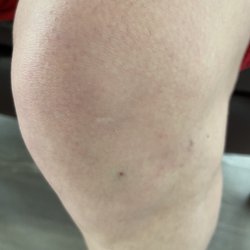 Skin Cancer & Cosmetic Surgery Center of NJ