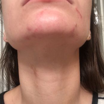 New Nails & Spa - Do not go here! Took skin off during my wax!! I can't even wear make up now! - Nail Salons Near Me - Spring, Texas New Nails & Spa - Do not go here! Took skin off during my wax!! I can't even wear make up now! - Nail Salons Near Me - Spring, Texas