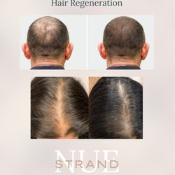 Michelle Lee Ink - All natural ingredients, these results are from 2-3 sessions 4 weeks apart.
