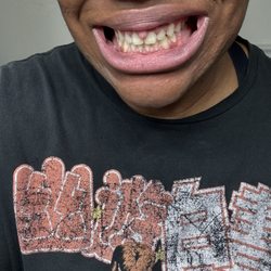 Harvey and Thomas Orthodontics - After