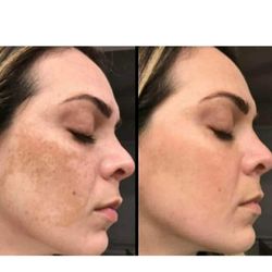 Keller Med Spa & Laser - Advatx