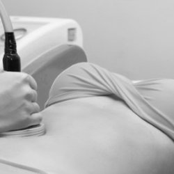 Body Fizique Contouring - Radio Frequency Body Contouring (Cavitation)