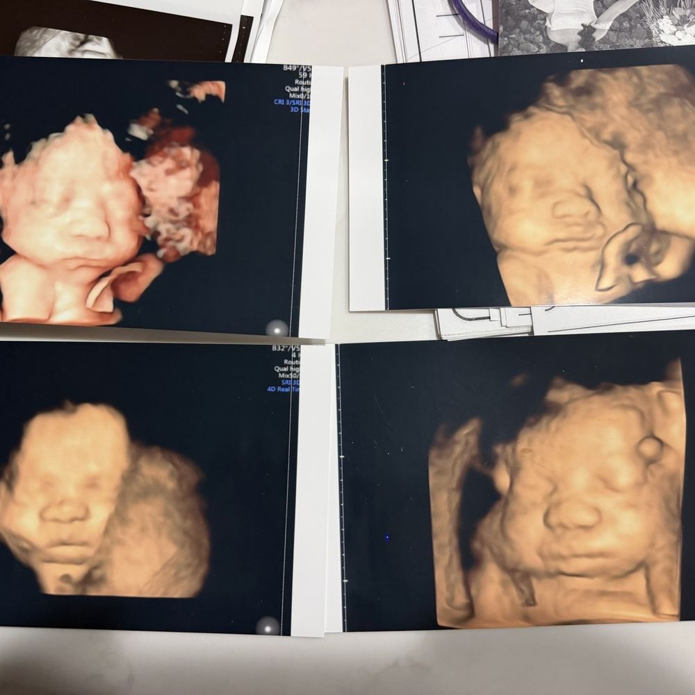 Baby’s First Glance - Ultrasound Imaging Centers Near Me - San Jose, California Baby’s First Glance - Ultrasound Imaging Centers Near Me - San Jose, California