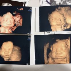 Baby’s First Glance